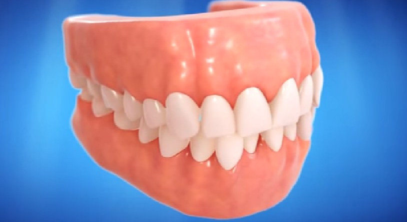 Negative Effects of Misaligned Teeth