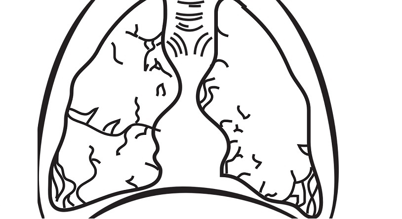 Mesothelioma Treatments